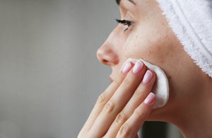 Acne: cause e rimedi