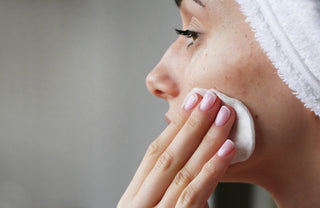 Acne: cause e rimedi